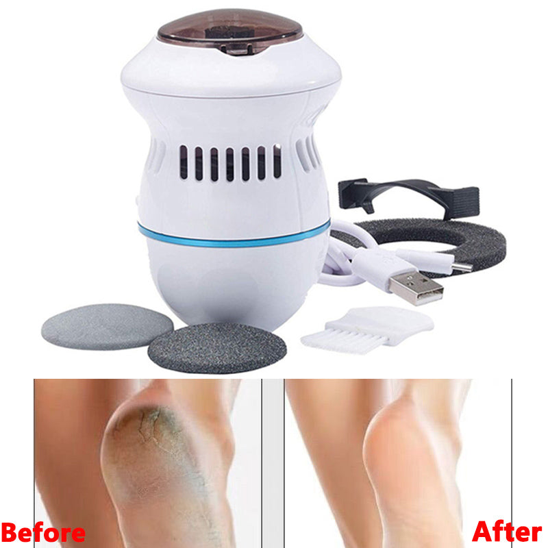 New Arrivals Pedi Remover Vac Rechargeable